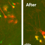 Light sheet images of a tissue cleared mouse brain. (left) before alignment, clear misalignments of the channels can be observed. (right) after 3D alignment, the color channels overlap