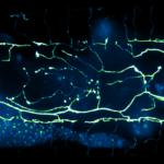 The complex structure of the mechanosensory PVD neuron in C. elegans, which displays neuronal beads upon aging and cold-shock exposure, make quantitative analysis of degeneration challenging.