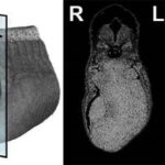 3D Nano-CT image of a whole Xenopus embryo, with both raw (black and white) and segmented 2D projections through the stomach. The color-coding highlights the left and right inner (endoderm) and outer (mesoderm) tissue layers.