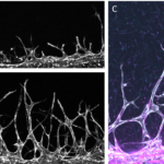 In adults, new blood vessels form via a process called angiogenesis. We can watch endothelial cells (white) sprout into a hydrogel chamber, resulting in different degrees of sprouting depending on whether the gel contains cells from healthy tissue (A) or cancer (B). These cells also produce extracellular matrix such as collagen 1 (magenta), remodeling their environment as they extend sprouts (C).